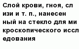 question