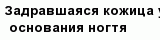 question
