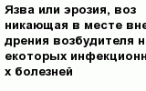 question